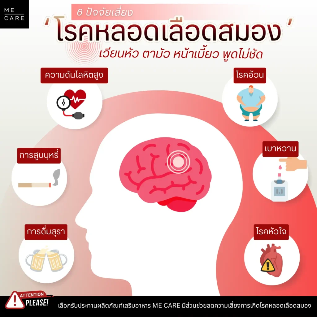 โรคหลอดเลือดสมอง Web H